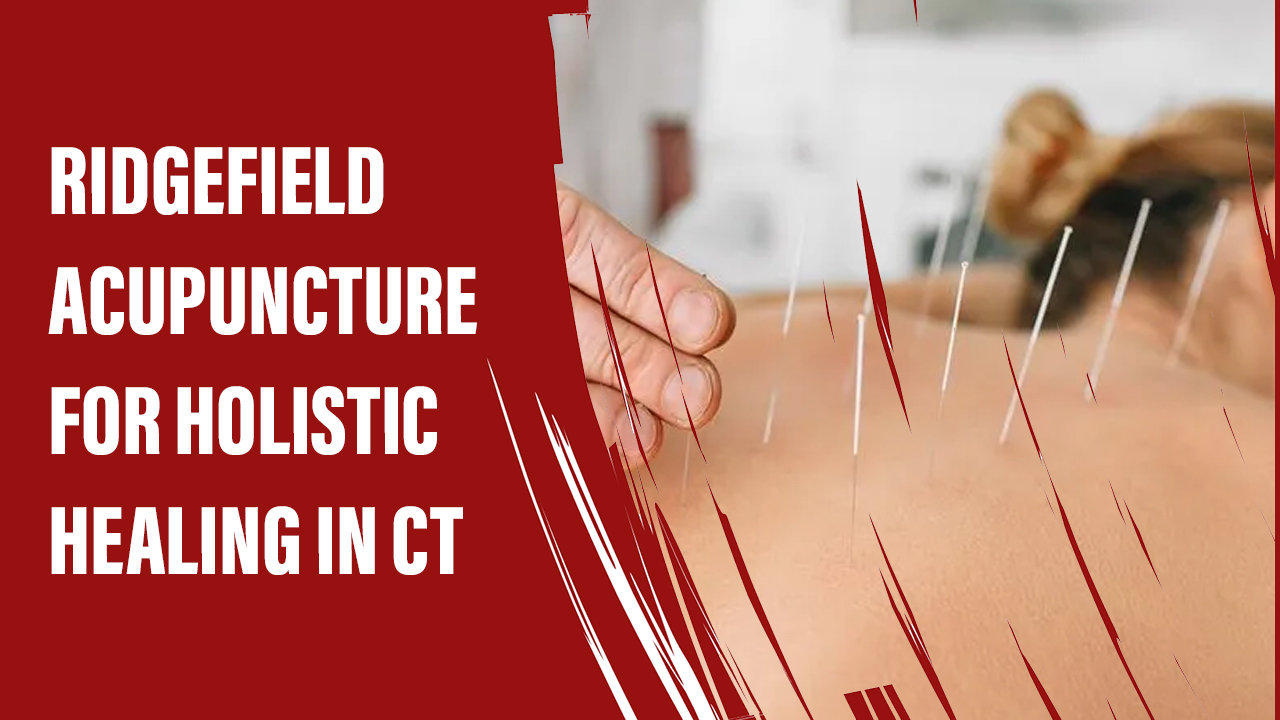 Ridgefield Acupuncture